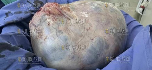 врачи в Софии удалили 20-килограммовую опухоль